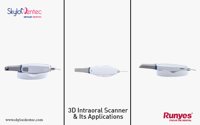 3D Intraoral scanner: The Newage Revolutionary Dental Equipment